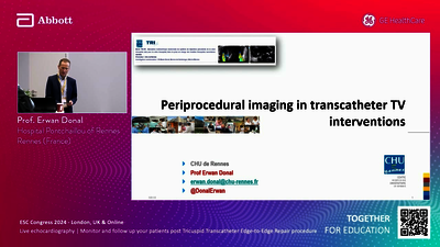 250623_ABBOTT_ESC_LONDON_TRICUSPID_EP3