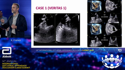 16 9-EH-5-16077-01 04-2025 Freixa mp4